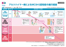アルツハイマー病によるMCIから認知症の進行経過（LEQ1122）