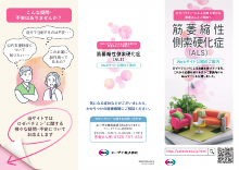 筋萎縮性側索硬化症（ALS）Webサイト公開のご案内（RBM1033）