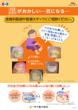 （皮膚科医療機関向け）【疾患啓発ポスター】爪がおかしい・・・気になる・・・(NLI1091​)