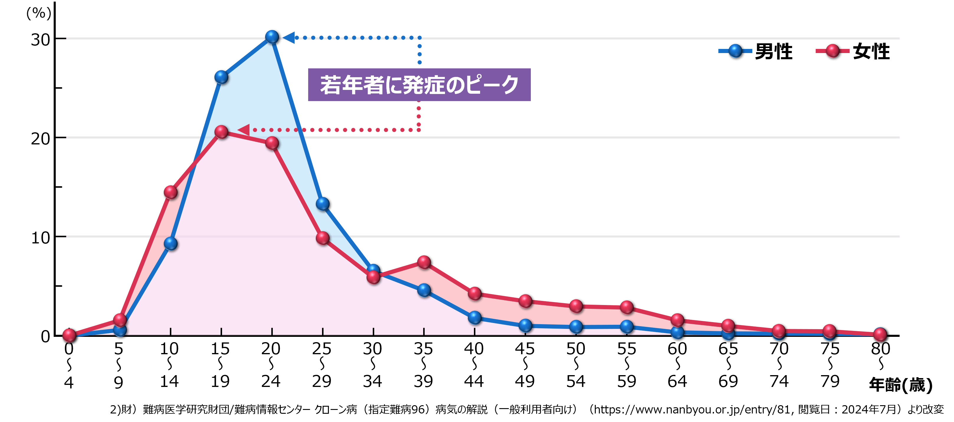 クローン病は若年発症が多い（グラフ）