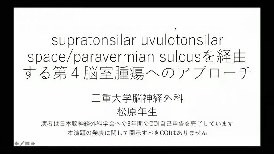 2. supratonsilar uvulotonsilar space / paravermian sulcusを経由する第4脳室腫瘍へのアプローチ （前編）