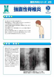 整形外科シリーズ25 強直性脊椎炎