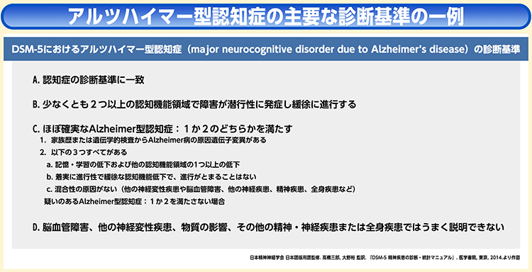 アルツハイマー型認知症の主要な診断基準の一例
